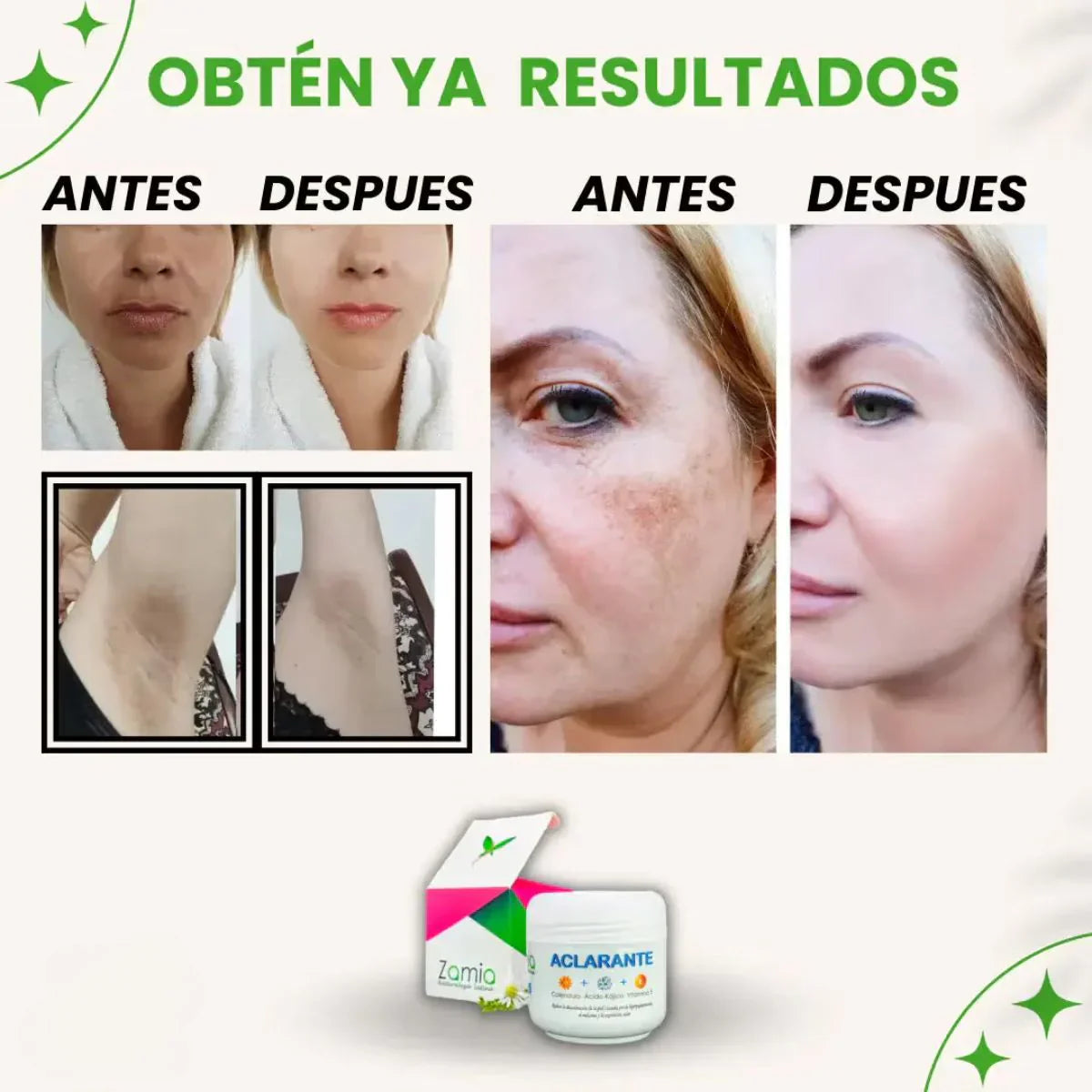 Crema Aclarante Zamia™ - Elimina manchas y mejora tu piel