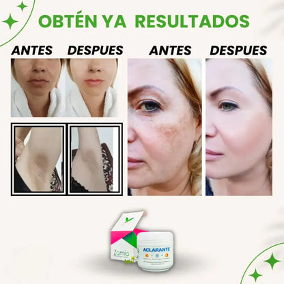 Crema Aclarante Zamia™ - Elimina manchas y mejora tu piel