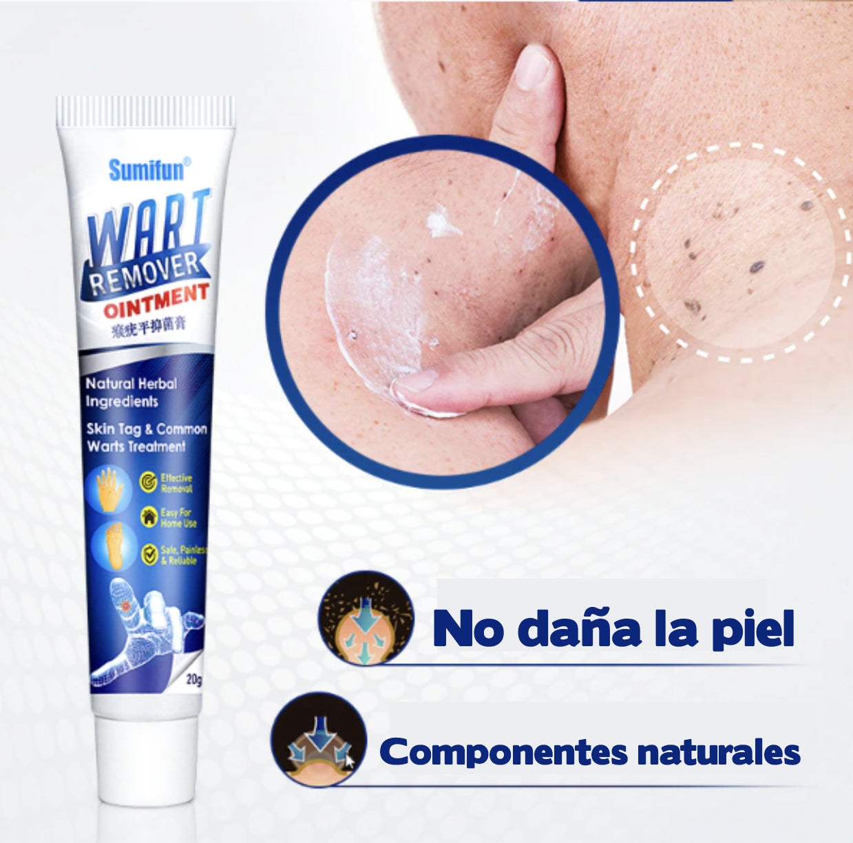WartOff™ - Crema removedora de verrugas